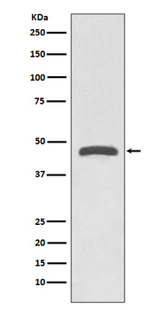 TSG101 Rabbit mAb Antibody