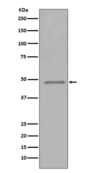 FOXP3 Rabbit mAb Antibody