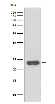 MGMT Rabbit mAb Antibody