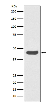 PD-L1 (CD274) Rabbit mAb Antibody