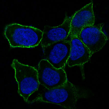 Integrin alpha 5 Rabbit mAb [KD Validated]