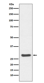 Caspase-14 Rabbit mAb