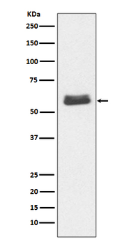 Caspase-10 Rabbit mAb Antibody