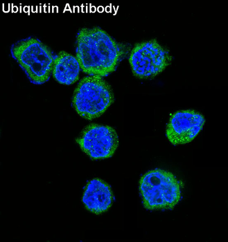Ubiquitin Rabbit mAb Antibody
