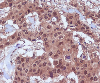 Ubiquitin Rabbit mAb Antibody