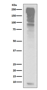 Ubiquitin Rabbit mAb Antibody