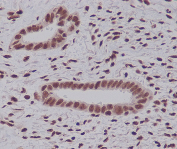 K48-linkage Specific Ubiquitin Rabbit mAb Antibody