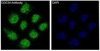 CDC34 Rabbit mAb Antibody