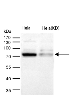 Cdc16/APC6 Rabbit mAb [KD Validated]