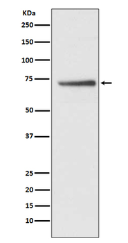 Cdc16/APC6 Rabbit mAb [KD Validated]
