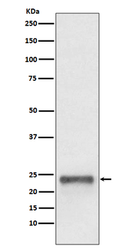 Ubiquitin D Rabbit mAb Antibody