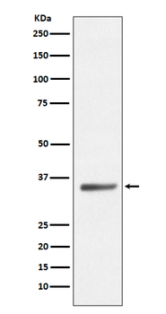 SIRT5 Rabbit mAb Antibody