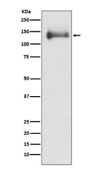 HDAC4 Rabbit mAb [KD Validated]
