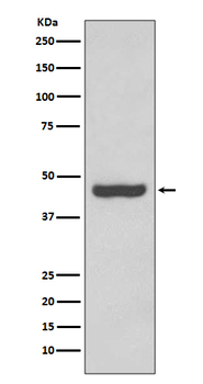 PAX2 Rabbit mAb Antibody