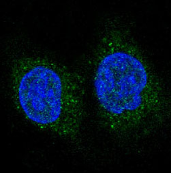 FoxO3a Rabbit mAb Antibody