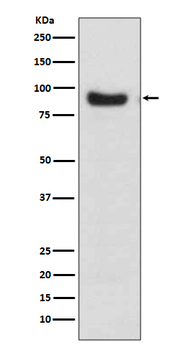 FoxO3a Rabbit mAb Antibody