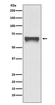 FoxO4 Rabbit mAb Antibody