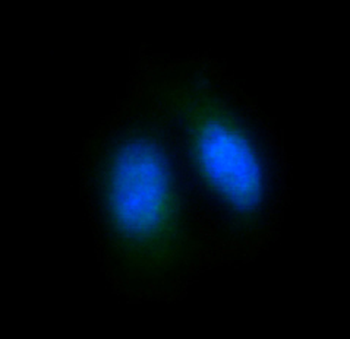 FoxO4 Rabbit mAb Antibody