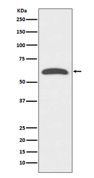 FoxO4 Rabbit mAb