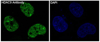 HDAC9 Rabbit mAb [KD Validated]