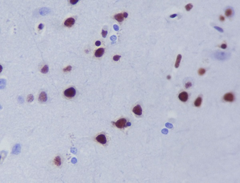 HDAC9 Rabbit mAb [KD Validated]