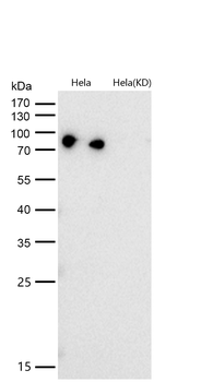 Stromal interaction molecule 1 Rabbit mAb [KD Validated] Antibody
