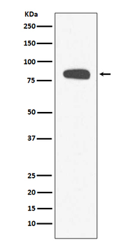 Stromal interaction molecule 1 Rabbit mAb [KD Validated] Antibody
