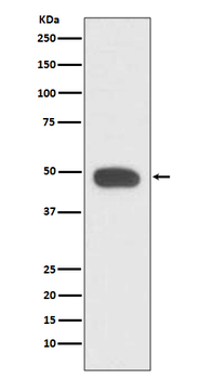 PAX6 Rabbit mAb Antibody