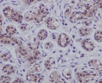 STAT5b Rabbit mAb Antibody
