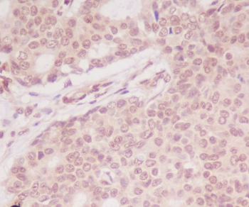 ATF5 Rabbit mAb Antibody