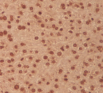 MEK3 Rabbit mAb Antibody