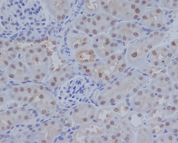 ATF4 Rabbit mAb Antibody