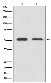 ATF4 Rabbit mAb Antibody