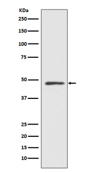 MEK7 Rabbit mAb Antibody