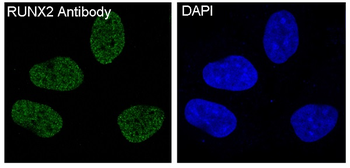 RUNX2 Rabbit mAb Antibody