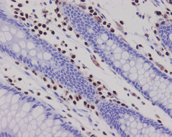 RUNX2 Rabbit mAb Antibody
