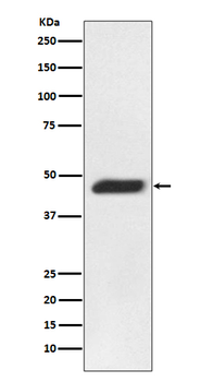 MEK2 Rabbit mAb Antibody