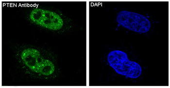 PTEN Rabbit mAb Antibody