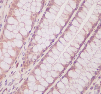 PTEN Rabbit mAb Antibody