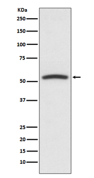 PTEN Rabbit mAb Antibody