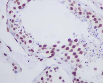 Histone H1.0 Rabbit mAb Antibody