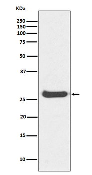 Histone H1.0 Rabbit mAb Antibody