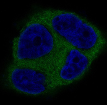 Tau Rabbit mAb Antibody