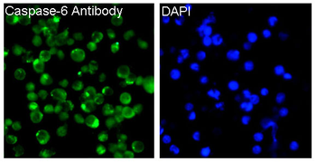Caspase-6 Rabbit mAb