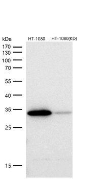 CDK4 Rabbit mAb [KD Validated] Antibody