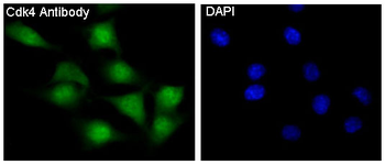 CDK4 Rabbit mAb [KD Validated] Antibody