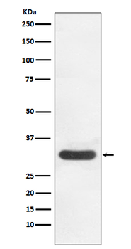 CDK4 Rabbit mAb [KD Validated] Antibody