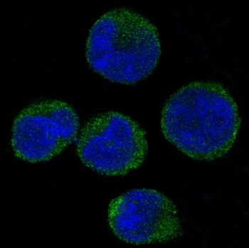 CDK6 Rabbit mAb Antibody