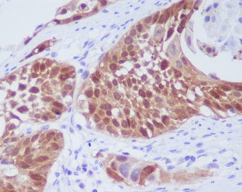 CDK6 Rabbit mAb Antibody