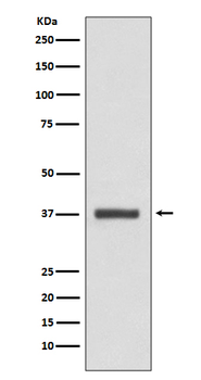 CDK6 Rabbit mAb Antibody